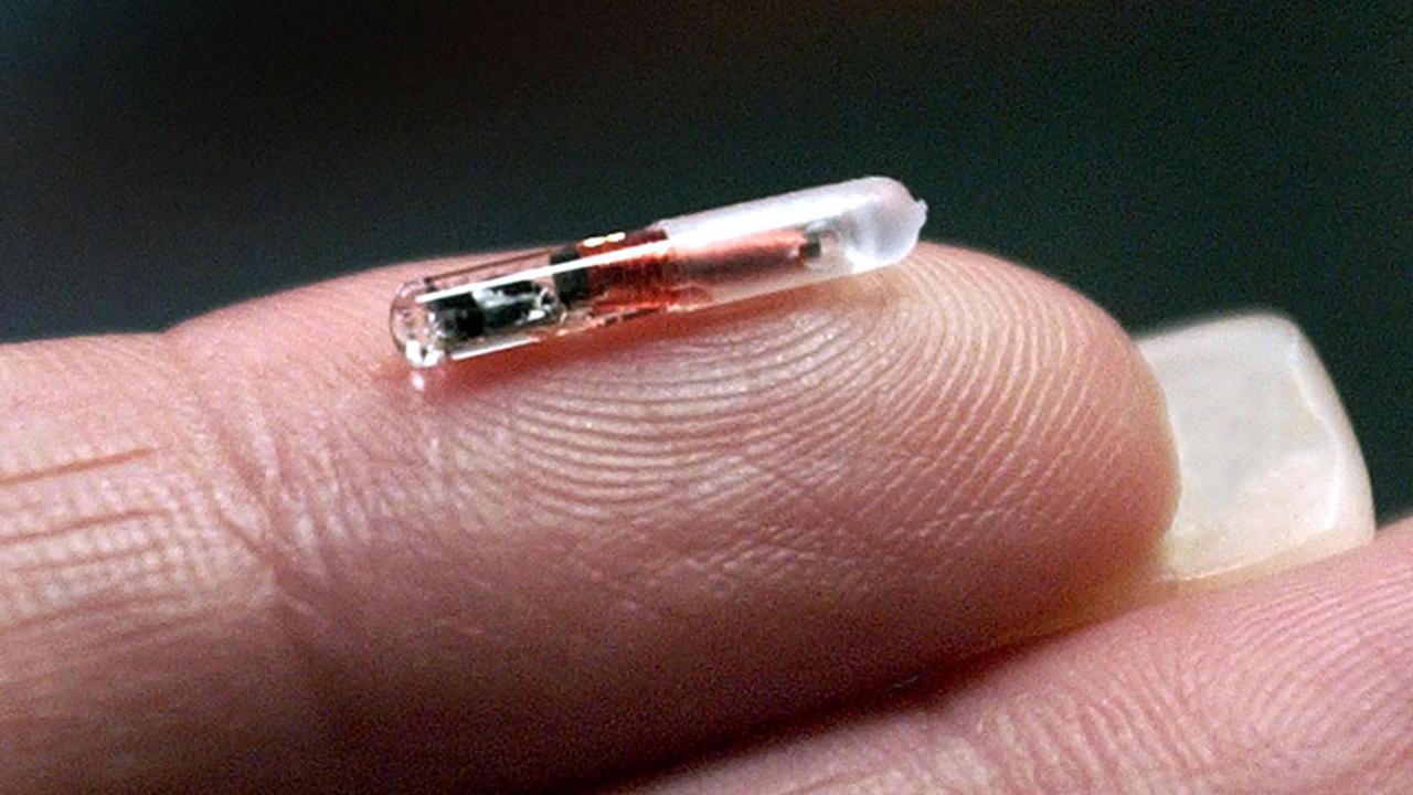 Những điểm ấn tượng về công nghệ cấy chip dưới da